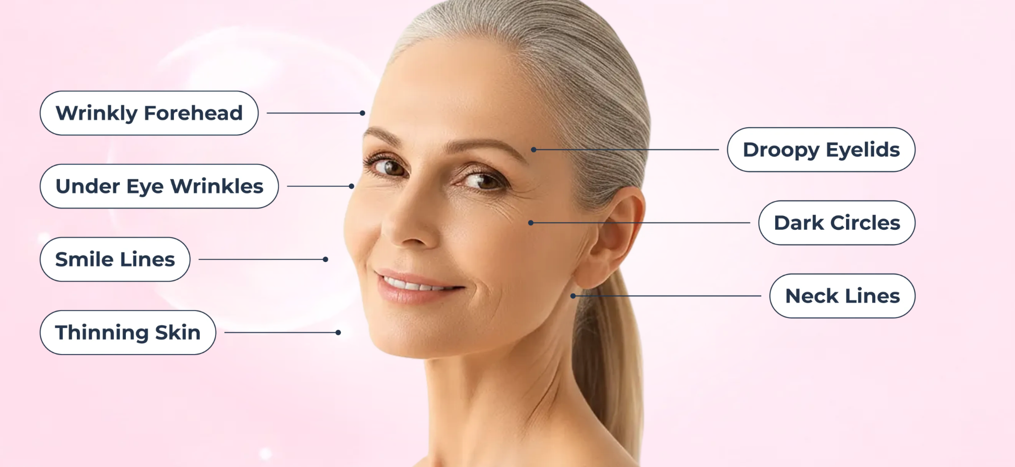 Illustration identifying common visible skin concerns including forehead lines, under-eye wrinkles, dark circles and neck lines